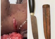 Penganiayaan Berat di Ponton Rajuk Tempilang, Pihak Kepolisian Buru Pelaku Penusukan Rekan Kerja