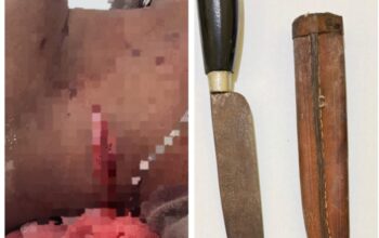 Penganiayaan Berat di Ponton Rajuk Tempilang, Pihak Kepolisian Buru Pelaku Penusukan Rekan Kerja