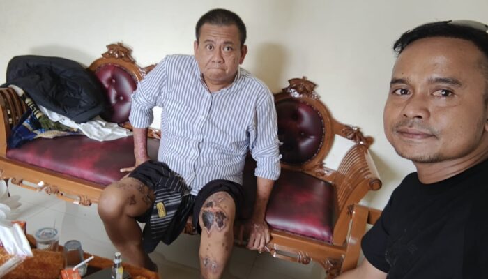 Ketua LBH Milenial Bung Dodoy Siap Mendampingi Kasus Penyiraman Air Keras Terhadap Aktivis Rosidi Di Basel